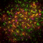 Un tipo de célula cerebral explica por qué el cannabis afecta a la memoria en la adolescencia