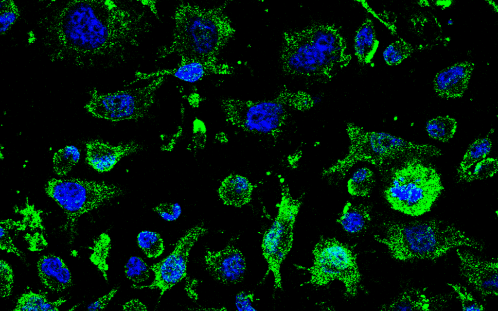 Un ensayo clínico abre una nueva vía contra la ELA: un fármaco español entra en fase de pruebas en humanos
